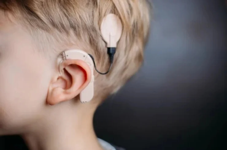 Cochlear Implant Rehabilitation